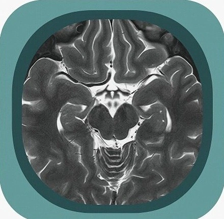 mri ventricles and cistern anatomy icon